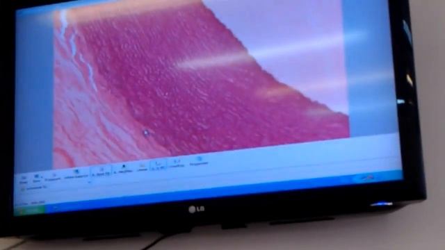 Гистология. Сосуды смотреть онлайн