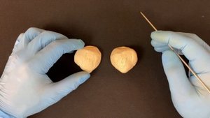 Надколенник - Patella (анатомия человека)