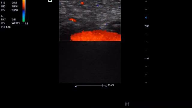 образование молочной железы. смотреть онлайн