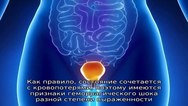 Почему болит в области мочевого пузыря