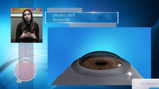 CEO - RAMON BRIM NATALIA - LASER EN REFRACCION - versión 2 смотреть онлайн