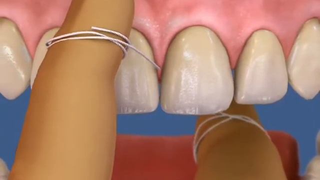 Как правильно пользоваться флоссом. смотреть онлайн