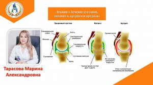 Лекция "Лечение суставов, синовита, артрита и артроза"