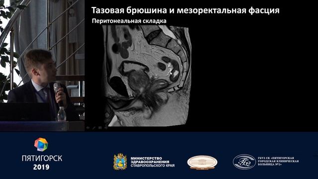 Лучевая анатомия и диагностика онкологических заболеваний прямой кишки. Петров К.С.