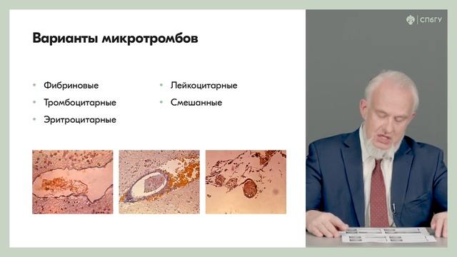 5.3 Морфология шока, сепсиса и диссеминированного внутрисосудистого свертывания смотреть онлайн