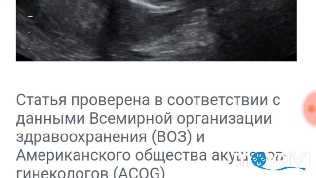 16 недель//беременность после КС//Первые шевеления// Мои ощущения