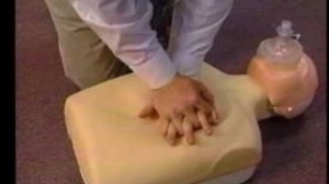 Сердечно-легочная реанимация.