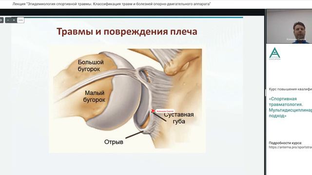Эпидемиология спортивной травмы  Классификация травм и болезней опорно-двигательного аппарата