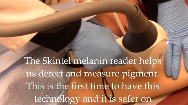 New Vectus Laser for Laser Hair Removal смотреть онлайн