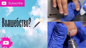 Преображение проблемных ручек // Что это волшебство или тактика? // Кто что сгрыз?