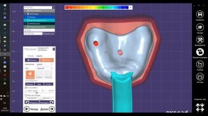Exocad Индивидуальная ложка
