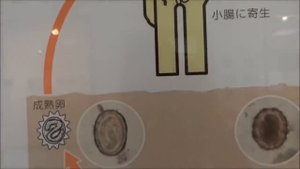 Музей Паразитов, Единственный в Мире, Токио, Япония