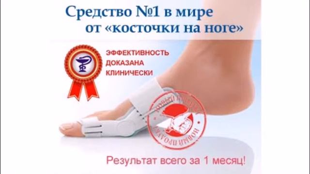 Шишка на косточке ноги