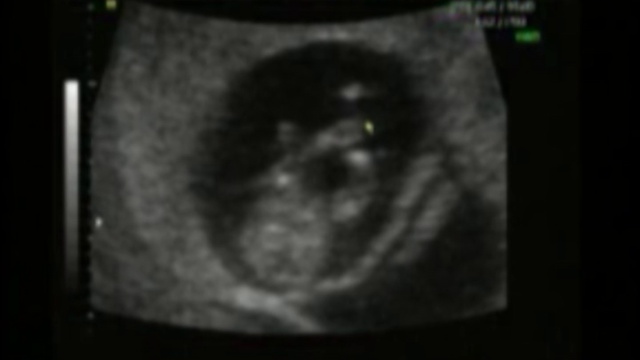 ЭВА УЗИ 2008 г смотреть онлайн