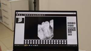 ВИЗИОГРАФ НАШЕ ФСЕ! Топ за свои деньги!