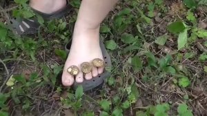Грибок ногтей (nail fungus)