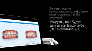 Invisalign - iTero Scan Day 2023 в клинике Ambassador Алматы (18-19 июля)