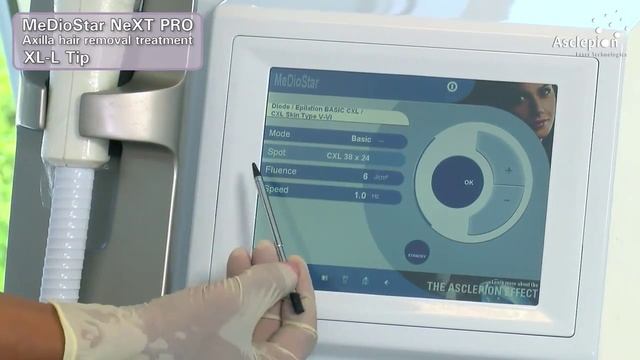 MeDioStar NeXT PRO XL - процедура лазерного удаления волос в режиме BASIC от Asclepion смотреть онлайн