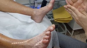 Ортоз из мягкого силикона