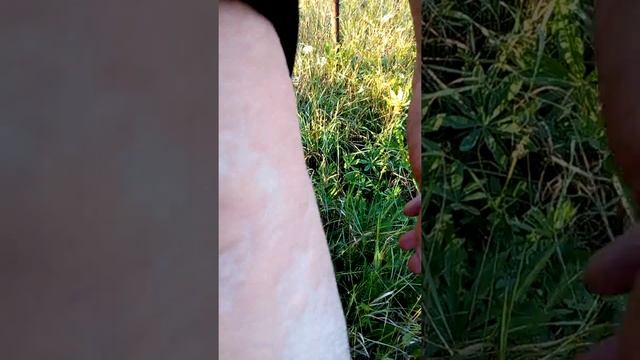 Аллергия на пчелиный укус смотреть онлайн