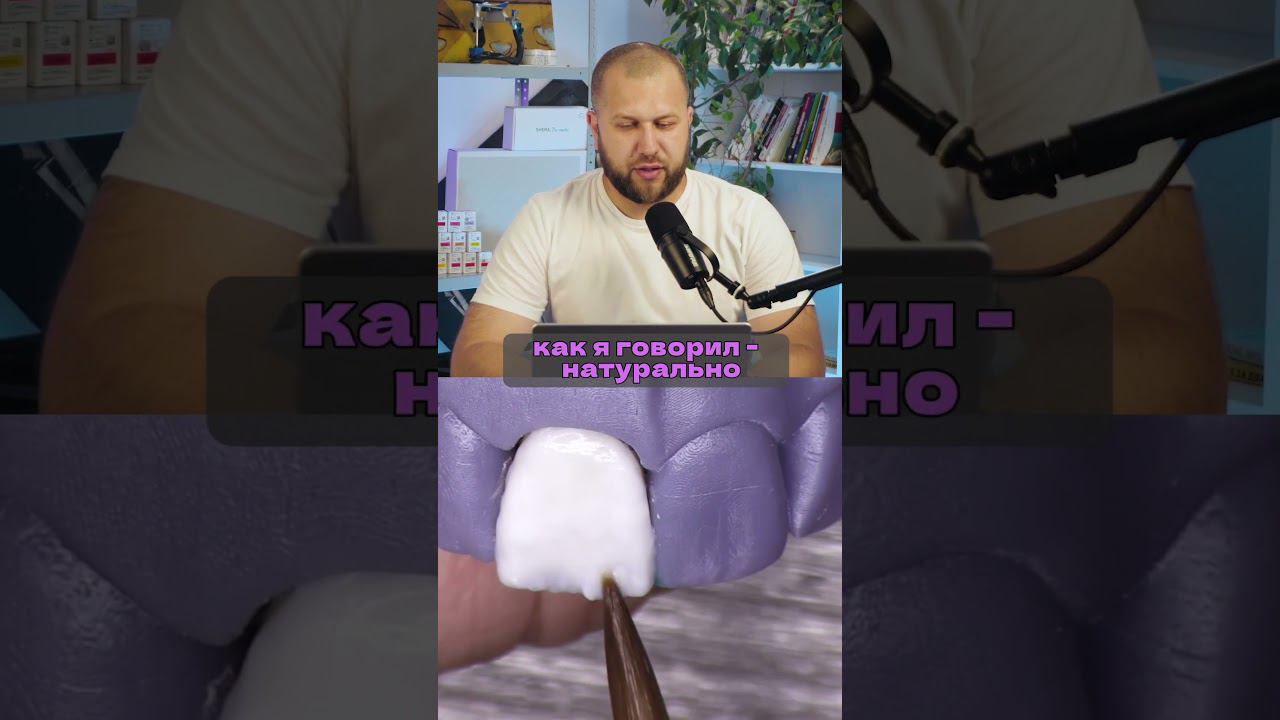 Как сделать виниры своими руками #зубнойтехникмосква #cadcam #виниры #зубы #exocad  #стоматолог