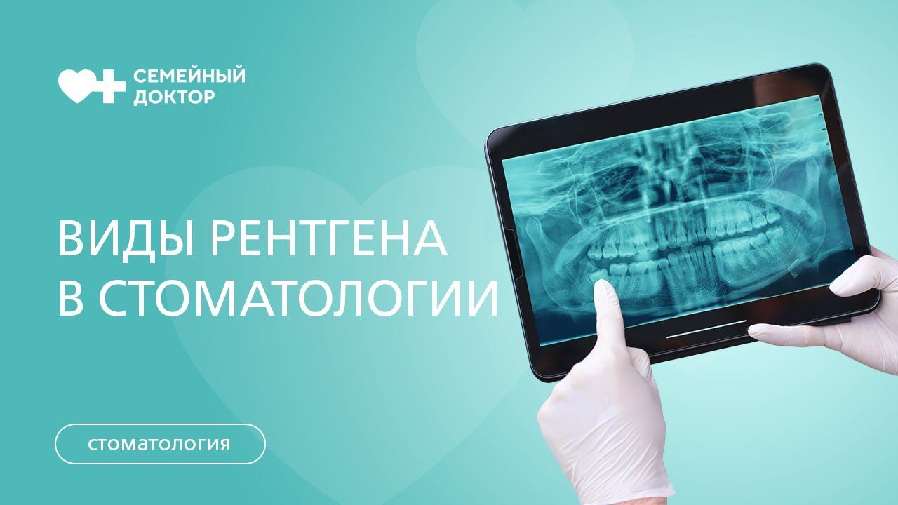 Зачем делают рентген-снимок зубов? Виды рентгенологического исследования в стоматологии.