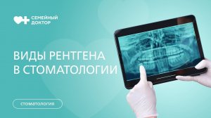Зачем делают рентген-снимок зубов? Виды рентгенологического исследования в стоматологии.