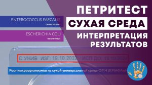 Интерпретация результатов на сухих подложках "Петритест"