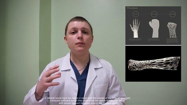 Новая ШИНА. 3D Печать. Альтернатива Гипса. 3D Printed Cast смотреть онлайн