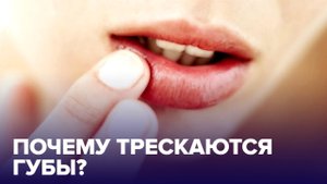 Почему ТРЕСКАЮТСЯ губы? Причины и что с этим делать
