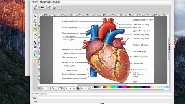 Anki for medical school: Studying anatomy using image occlusion