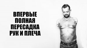 Первая в мире полная пересадка рук и плеча. История из жизни.