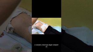 Перевязка после сеанса гирудотерапии