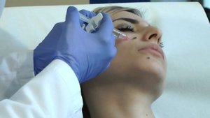 PROFHILO BAP TECHNIQUE