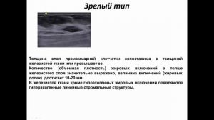 Ультразвуковые морфотипы молочных желез
