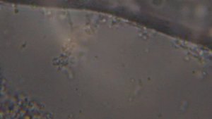 Молочнокислый стрептококк в ряженке