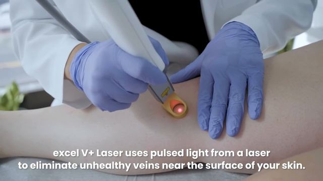 Excel V+ laser | Best Varicose and Spider Vein Treatments | Metro Vein Centers смотреть онлайн
