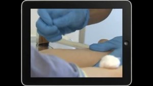 Всё о реакции Манту.