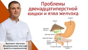 Проблемы двенадцатиперстной кишки и язва желудка. Причина возникновения и как лечить