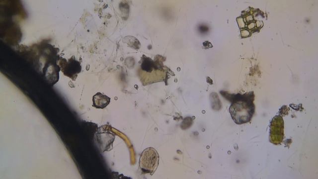 part 1 light field : bacteria, ciliates, часть 1 светлое поле : бактерии , инфузории смотреть онлайн