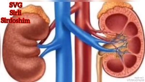 Буйрак касаллигидан бутунлай халос булишни истайсизми