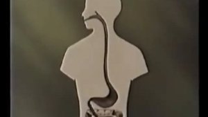 Тип  Круглые черви. Паразитические круглые черви