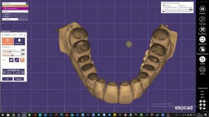 3Д моделирование циркониевых коронок в зуботехнической лаборатории "Эстетикс"