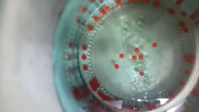 Как ростут Арбизы! смотреть онлайн