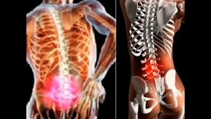 Рецепт мази на основе лаврового листа от боли в спине