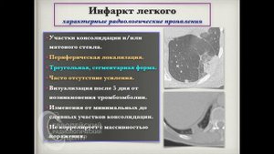 Часть 3. Тромбоэмболия легочных артерий с легочной гипертензией. Инфаркт легкого.  Андрей Мангов