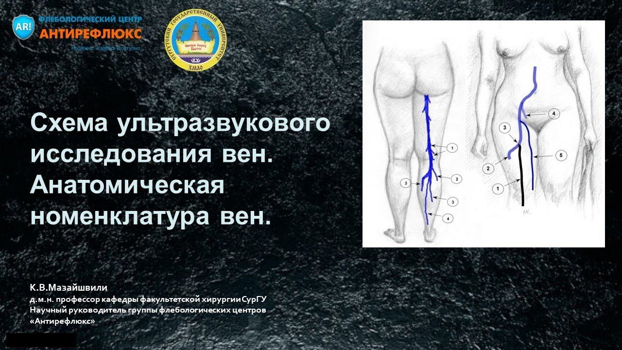 вебинар Схема ультразвукового исследования вен