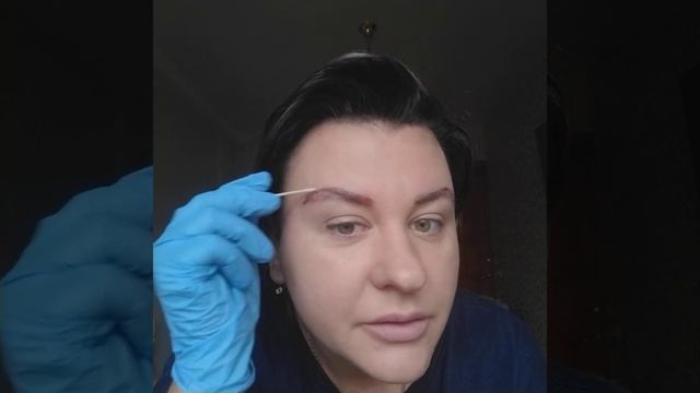 Уход после процедуры удаление татуажа ремувером. Использование жидкого лазера. смотреть онлайн