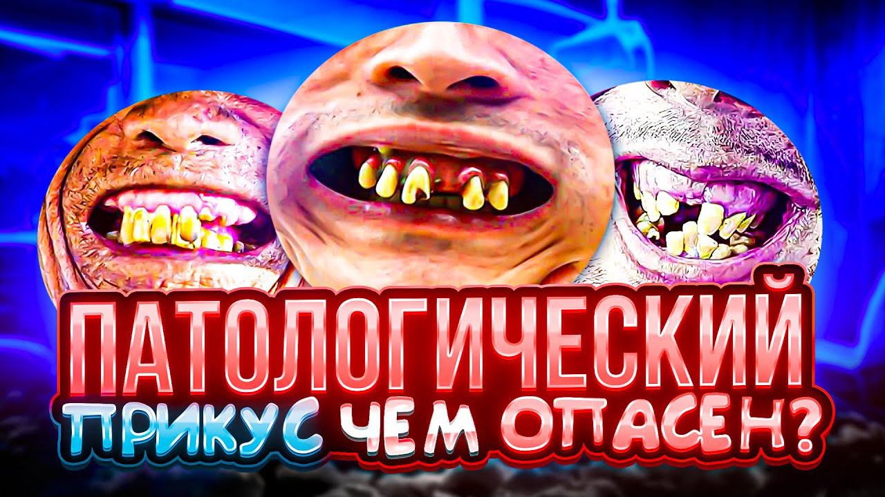 Каким бывает прикус и как его исправить?