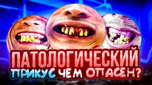 Каким бывает прикус и как его исправить?